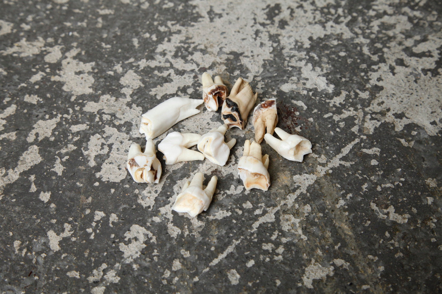 Mixed teeth, large